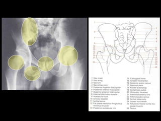 Musculoskeletal Imaging 09