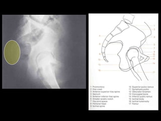 Musculoskeletal Imaging 09