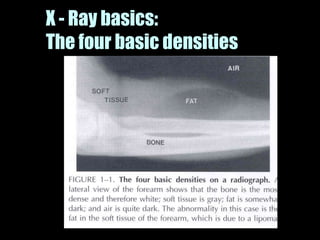 Musculoskeletal Imaging 09