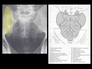 Musculoskeletal Imaging 09