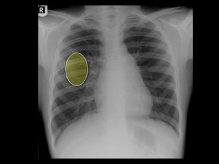 Musculoskeletal Imaging 09