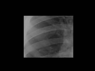 Musculoskeletal Imaging 09