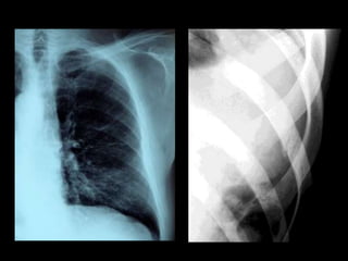 Musculoskeletal Imaging 09