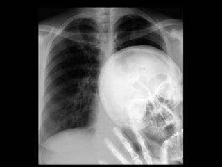 Musculoskeletal Imaging 09