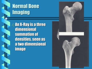 Musculoskeletal Imaging 09