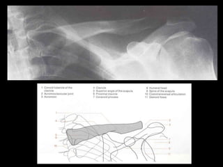 Musculoskeletal Imaging 09
