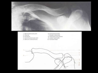 Musculoskeletal Imaging 09