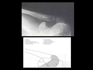 Musculoskeletal Imaging 09