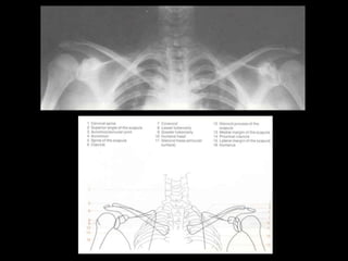 Musculoskeletal Imaging 09
