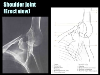 Musculoskeletal Imaging 09