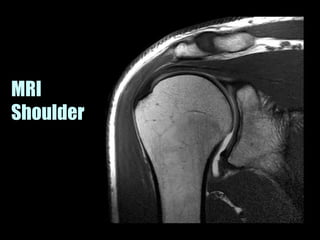 Musculoskeletal Imaging 09