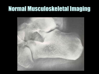 Musculoskeletal Imaging 09