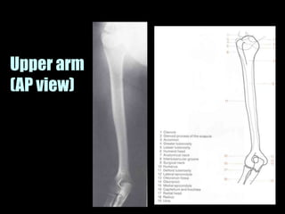 Musculoskeletal Imaging 09
