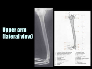 Musculoskeletal Imaging 09