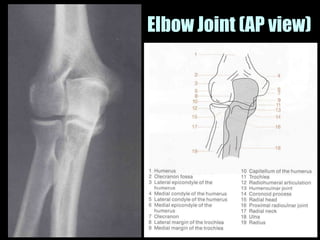 Musculoskeletal Imaging 09