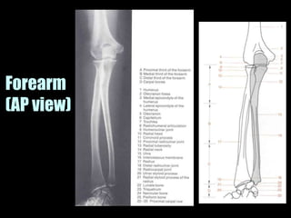 Musculoskeletal Imaging 09