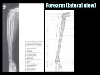 Musculoskeletal Imaging 09