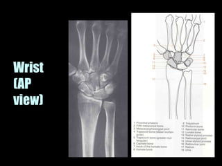 Musculoskeletal Imaging 09