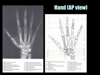 Musculoskeletal Imaging 09