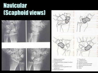 Musculoskeletal Imaging 09