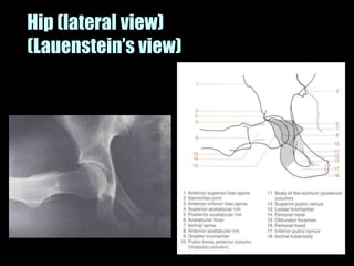 Musculoskeletal Imaging 09