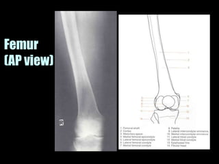 Musculoskeletal Imaging 09