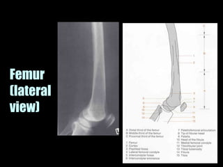 Musculoskeletal Imaging 09