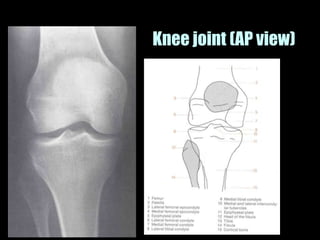 Musculoskeletal Imaging 09