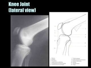 Musculoskeletal Imaging 09