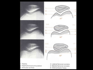 Musculoskeletal Imaging 09