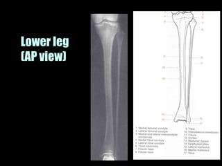 Musculoskeletal Imaging 09