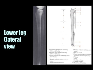 Musculoskeletal Imaging 09
