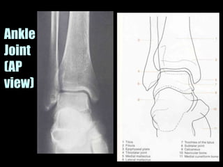 Musculoskeletal Imaging 09