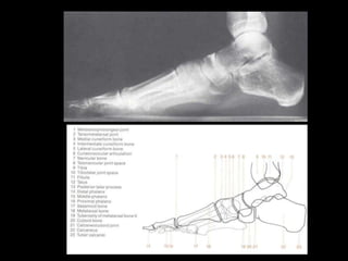 Musculoskeletal Imaging 09