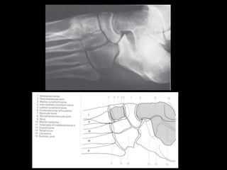Musculoskeletal Imaging 09