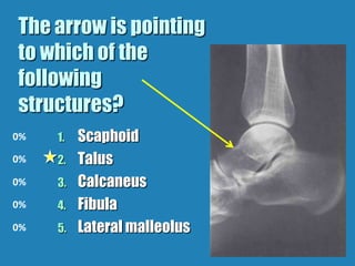 Musculoskeletal Imaging 09