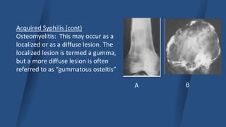 Semga Infection Musculoskeletal infection basics by capt alauddin.pptx