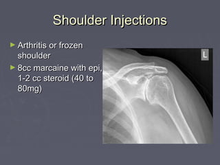 Musculoskeletal injections | PPT