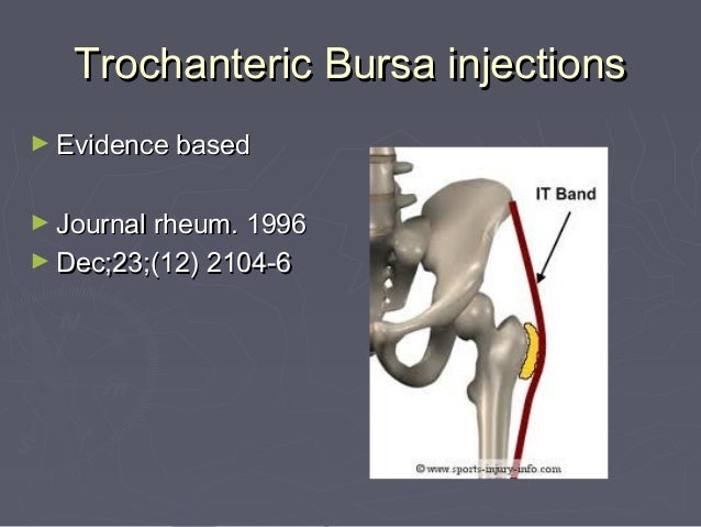 steroid injection for shoulder bursitis steroid injection for shoulder bursitis