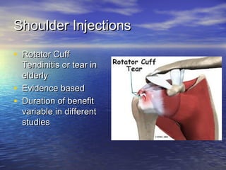 Retroscapular Injection Musculoskeletal injections | PPT