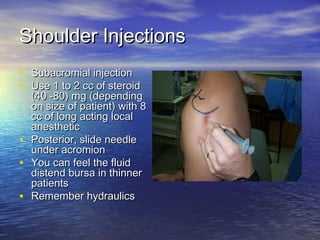 Musculoskeletal injections | PPT