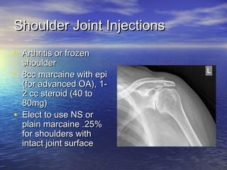 Musculoskeletal injections | PPT