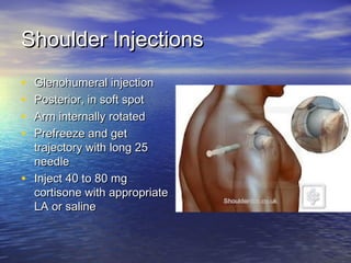 Shoulder Injection Location Chart Musculoskeletal injections | PPT