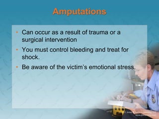 Define Mutilation MUSCULOSKELETAL INJURY.ppt
