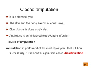 Closed amputation
 It is a planned type .
 The skin and the bone are not at equal level.
 Skin closure is done surgically.
 Antibiotics is administered to prevent re infection
levels of amputation
Amputation is performed at the most distal point that will heal
successfully. If it is done at a joint it is called disarticulation.
73
pic
 