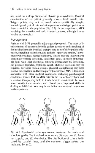 132 Jeffrey G. Jones and Doug Poplin
and result in a sleep disorder or chronic pain syndrome. Physical
examination of the patient generally reveals local muscle pain.
Trigger points may not be noted unless specifically sought.
Knowledge of typical pain radiation patterns and trigger point loca-
tions is useful to the physician (Fig. 6.2). In our experience, MPS
involving the shoulder and neck is most common, although it may
involve any muscle.13
Management
Patients with MPS generally enjoy a good prognosis. The most criti-
cal elements of treatment include patient education and stretching of
the involved muscle. Physical therapy may be useful for patient edu-
cation, stretching instruction, and perhaps “spray and stretch,” a pro-
cedure where a local vapocoolant spray is used over the involved area
immediately before stretching. In resistant cases, injection of the trig-
ger point with local anesthetic, followed immediately by stretching,
can produce dramatic, prolonged relief. Multiple injections may be
required. For some muscle groups, physical strengthening may help
resolve the condition and help to prevent recurrence. MPS is less often
associated with other medical conditions, including psychological
conditions, than is FM. In MPS patients the use of biofeedback and
relaxation therapy may help to teach them to discriminate between
unnecessarily tense muscles and relaxed ones. Improved skills in
dealing with life’s stresses may be useful for treatment and prevention
in these patients.
Fig. 6.2. Myofascial pain syndromes involving the neck and
shoulder girdle. The involved muscles are (1) trapezius, (2) leva-
tor scapula, and (3) rhomboids. The distribution of pain is indi-
cated by parallel lines, and the common trigger points are
indicated by an X.
 
