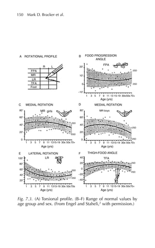 150 Mark D. Bracker et al.
ROTATIONAL PROFILE
C
MR girls
B
FPA
R
FPA
MR
LR
TFA
Foot
L 20⬚
10⬚
20⬚
40⬚
60⬚
80⬚
0
20⬚
20⬚ −40⬚
−20⬚
20⬚
40⬚
0
40⬚
60⬚
80⬚
100⬚
40⬚
60⬚
80⬚
0
1
1
3
3
5
5 7 9 11 1315-19 30s 50s70+
7 9
Age (yrs)
TFA
11 1315-19 30s 50s 70+
1
1 3 5 7 9 11 1315-19 30s 50s70s
3 5 7 9
Age (yrs)
E F
LATERAL ROTATION THIGH-FOOD ANGLE
LR
Age (yrs) Age (yrs)
11 1315-19 30s 50s 70+
−10⬚
1 3 5 7 9 11
Age (yrs)
MR boys
D
13 15-19 30s50s 70+
2SD
2SD
2SD
2SD
2SD
2SD
2SD
2SD
2SD
2SD
0
MEDIAL ROTATION
A FOOD PROGRESSION
ANGLE
MEDIAL ROTATION
Fig. 7.3. (A) Torsional profile. (B–F) Range of normal values by
age group and sex. (From Engel and Staheli,2
with permission.)
 
