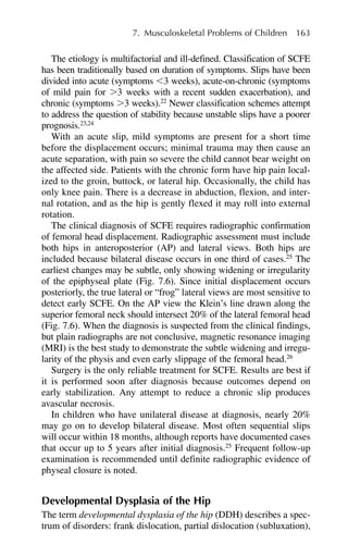 The etiology is multifactorial and ill-defined. Classification of SCFE
has been traditionally based on duration of symptoms. Slips have been
divided into acute (symptoms ⬍3 weeks), acute-on-chronic (symptoms
of mild pain for ⬎3 weeks with a recent sudden exacerbation), and
chronic (symptoms ⬎3 weeks).22
Newer classification schemes attempt
to address the question of stability because unstable slips have a poorer
prognosis.23,24
With an acute slip, mild symptoms are present for a short time
before the displacement occurs; minimal trauma may then cause an
acute separation, with pain so severe the child cannot bear weight on
the affected side. Patients with the chronic form have hip pain local-
ized to the groin, buttock, or lateral hip. Occasionally, the child has
only knee pain. There is a decrease in abduction, flexion, and inter-
nal rotation, and as the hip is gently flexed it may roll into external
rotation.
The clinical diagnosis of SCFE requires radiographic confirmation
of femoral head displacement. Radiographic assessment must include
both hips in anteroposterior (AP) and lateral views. Both hips are
included because bilateral disease occurs in one third of cases.25
The
earliest changes may be subtle, only showing widening or irregularity
of the epiphyseal plate (Fig. 7.6). Since initial displacement occurs
posteriorly, the true lateral or “frog” lateral views are most sensitive to
detect early SCFE. On the AP view the Klein’s line drawn along the
superior femoral neck should intersect 20% of the lateral femoral head
(Fig. 7.6). When the diagnosis is suspected from the clinical findings,
but plain radiographs are not conclusive, magnetic resonance imaging
(MRI) is the best study to demonstrate the subtle widening and irregu-
larity of the physis and even early slippage of the femoral head.26
Surgery is the only reliable treatment for SCFE. Results are best if
it is performed soon after diagnosis because outcomes depend on
early stabilization. Any attempt to reduce a chronic slip produces
avascular necrosis.
In children who have unilateral disease at diagnosis, nearly 20%
may go on to develop bilateral disease. Most often sequential slips
will occur within 18 months, although reports have documented cases
that occur up to 5 years after initial diagnosis.25
Frequent follow-up
examination is recommended until definite radiographic evidence of
physeal closure is noted.
Developmental Dysplasia of the Hip
The term developmental dysplasia of the hip (DDH) describes a spec-
trum of disorders: frank dislocation, partial dislocation (subluxation),
7. Musculoskeletal Problems of Children 163
 