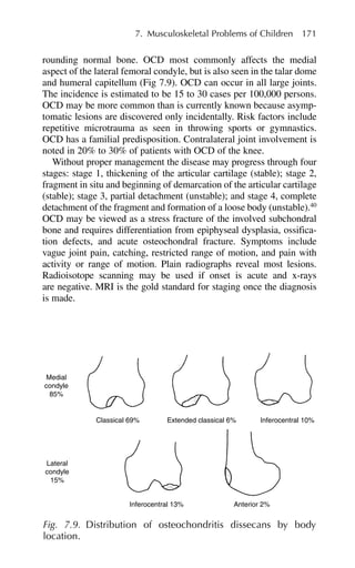 rounding normal bone. OCD most commonly affects the medial
aspect of the lateral femoral condyle, but is also seen in the talar dome
and humeral capitellum (Fig 7.9). OCD can occur in all large joints.
The incidence is estimated to be 15 to 30 cases per 100,000 persons.
OCD may be more common than is currently known because asymp-
tomatic lesions are discovered only incidentally. Risk factors include
repetitive microtrauma as seen in throwing sports or gymnastics.
OCD has a familial predisposition. Contralateral joint involvement is
noted in 20% to 30% of patients with OCD of the knee.
Without proper management the disease may progress through four
stages: stage 1, thickening of the articular cartilage (stable); stage 2,
fragment in situ and beginning of demarcation of the articular cartilage
(stable); stage 3, partial detachment (unstable); and stage 4, complete
detachment of the fragment and formation of a loose body (unstable).40
OCD may be viewed as a stress fracture of the involved subchondral
bone and requires differentiation from epiphyseal dysplasia, ossifica-
tion defects, and acute osteochondral fracture. Symptoms include
vague joint pain, catching, restricted range of motion, and pain with
activity or range of motion. Plain radiographs reveal most lesions.
Radioisotope scanning may be used if onset is acute and x-rays
are negative. MRI is the gold standard for staging once the diagnosis
is made.
7. Musculoskeletal Problems of Children 171
Medial
condyle
85%
Lateral
condyle
15%
Classical 69% Extended classical 6% Inferocentral 10%
Inferocentral 13% Anterior 2%
Fig. 7.9. Distribution of osteochondritis dissecans by body
location.
 