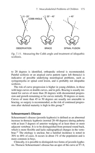 to 20 degrees is identified, orthopedic referral is recommended.
Painful scoliosis or an atypical curve pattern (apex left thoracic) is
indicative of possible underlying neurological problems, such as
syringomyelia or spinal cord lesion, and is probably not idiopathic
scoliosis.
The risk of curve progression is higher in young children, in those
with large curves or double curves, and in girls. Bracing is usually ini-
tiated for curves of more than 20 degrees with documented progres-
sion and growth remaining or for curves initially 30 degrees or more.
Curves of more than 45 to 50 degrees are usually not amenable to
bracing, so surgery is recommended, as the risk of continued progres-
sion after skeletal maturity is high in this group.46
Scheuermann’s Disease
Scheuermann’s disease (juvenile kyphosis) is defined as an abnormal
increase in thoracic kyphosis (normal 20–40 degrees) during puberty
with at least 5 degrees of anterior wedging of at least three or more
adjacent vertebrae. It is to be distinguished from postural round back,
which is more flexible and lacks radiographical changes in the verte-
brae.47
The etiology is unclear, but a familial incidence is noted in
30% to 48% of cases. It occurs in about 1% of the population and is
more common in boys.
Clinically, it is possible to distinguish two forms of juvenile kypho-
sis. Thoracic Scheuermann’s disease has an apex of the curve at T7–9,
7. Musculoskeletal Problems of Children 175
OBSERVATION
COBB ANGLE
0 - 25⬚ 25⬚ - 45⬚ > 45⬚
BRACE SPINAL FUSION
Fig. 7.11. Measuring the Cobb angle and treatment of idiopathic
scoliosis.
 